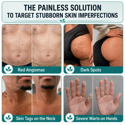 Effective MicroNeedle BotanicSkinTag Removal Patch