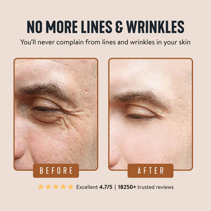 Wrinkle Defense Tallow Balm✨