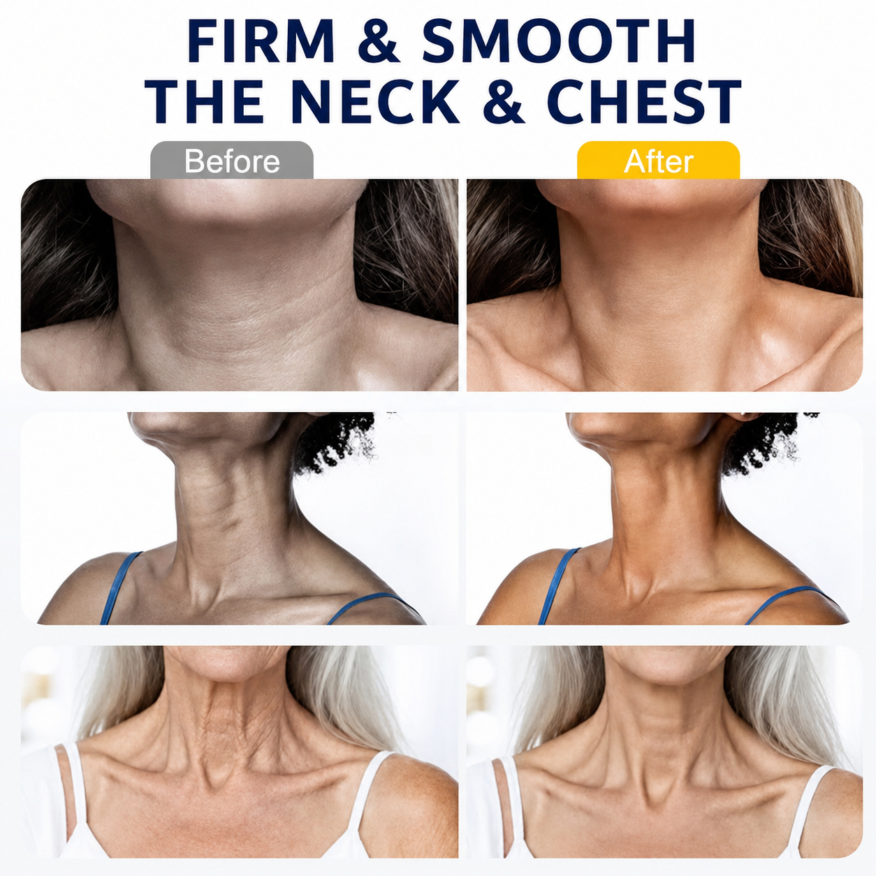 🦢 oliveavepolish® Neck & Chest Firming Roll-On Cream